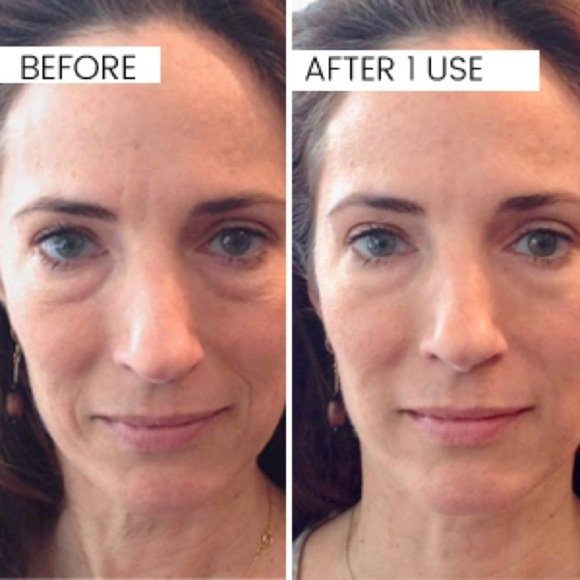 Gowinsee Face Wrinkle Patches - Fine Line Remover Strips - Picture 9 of 9